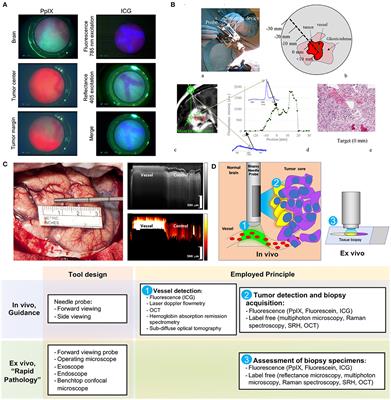 Current Trends for Improving Safety of Stereotactic Brain Biopsies: Advanced Optical Methods for Vessel Avoidance and Tumor Detection